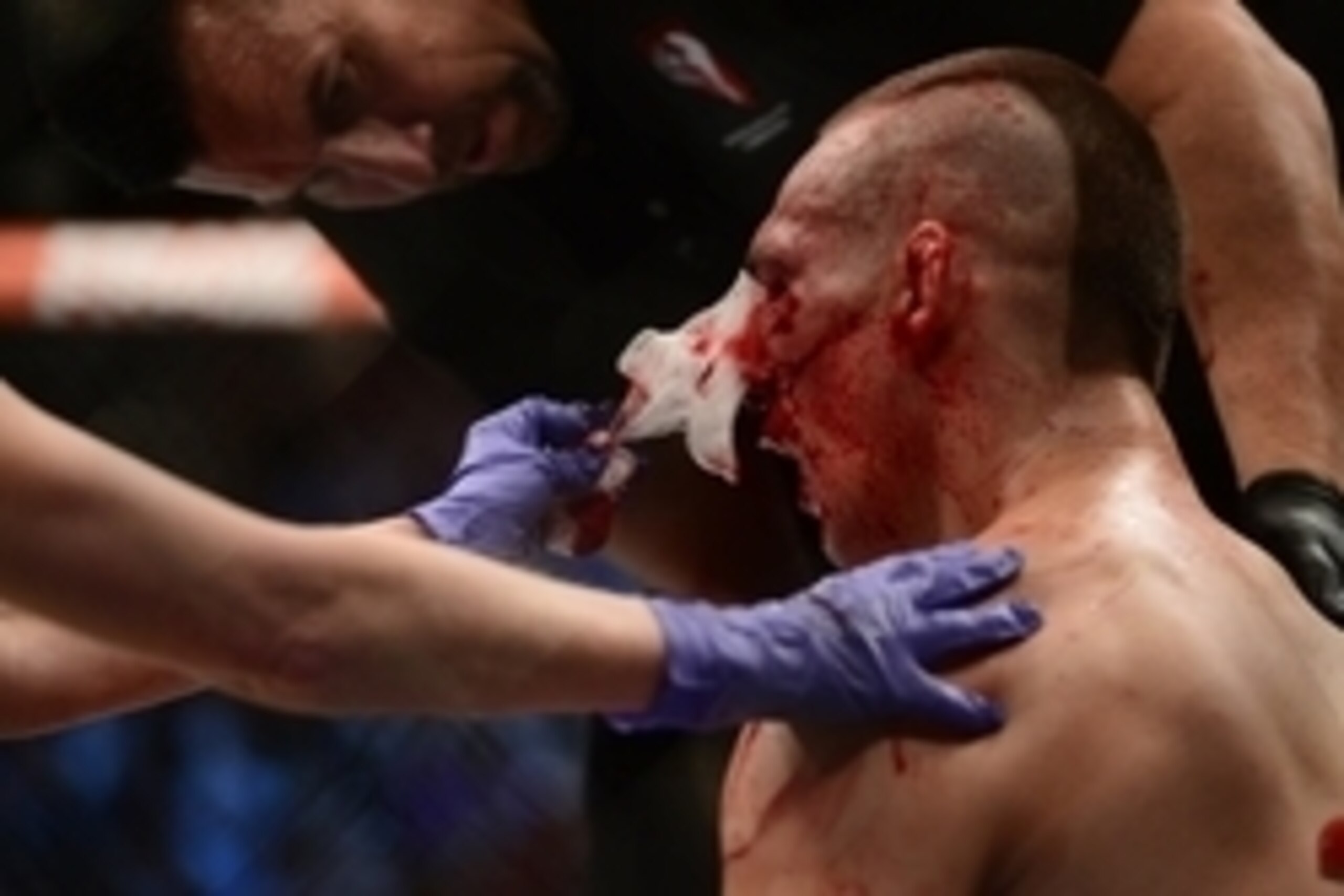 Jul 11, 2015; Las Vegas, NV, USA;  Rory MacDonald (blue gloves) is tended to while fighting Robbie Lawler (not pictured) during their welterweight title bout during UFC 189 at MGM Grand Garden Arena. Lawler won via fifth round TKO. Mandatory Credit: Joe C