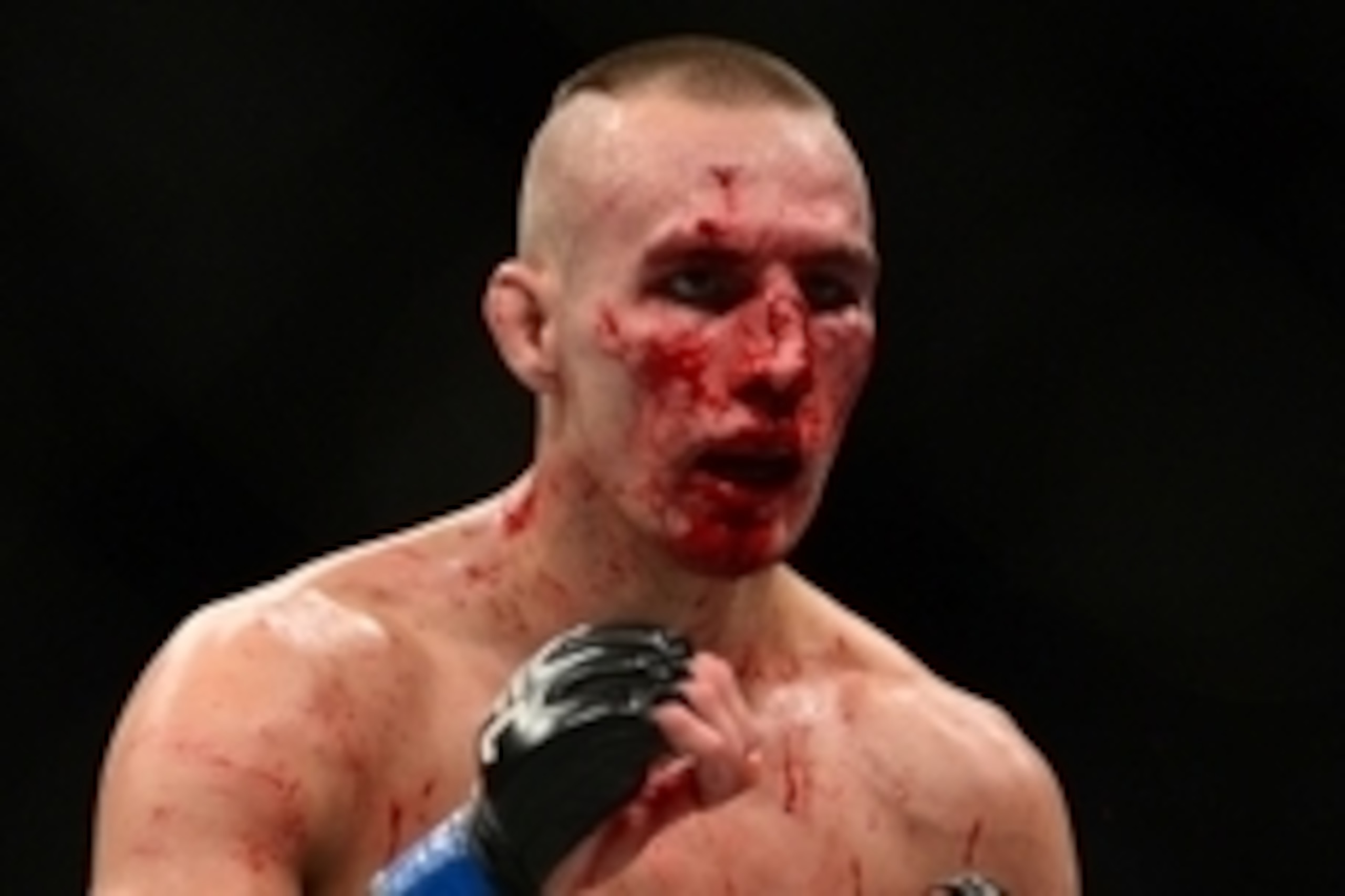 Jul 11, 2015; Las Vegas, NV, USA; Robbie Lawler (not pictured) and Rory MacDonald (blue gloves) fight during their welterweight title bout during UFC 189 at MGM Grand Garden Arena. Lawler won via fifth round TKO. Mandatory Credit: Joe Camporeale-USA TODAY Jul 11, 2015; Las Vegas, NV, USA; Robbie Lawler (not pictured) and Rory MacDonald (blue gloves) fight during their welterweight title bout during UFC 189 at MGM Grand Garden Arena. Lawler won via fifth round TKO. Mandatory Credit: Joe Camporeale-USA TODAY