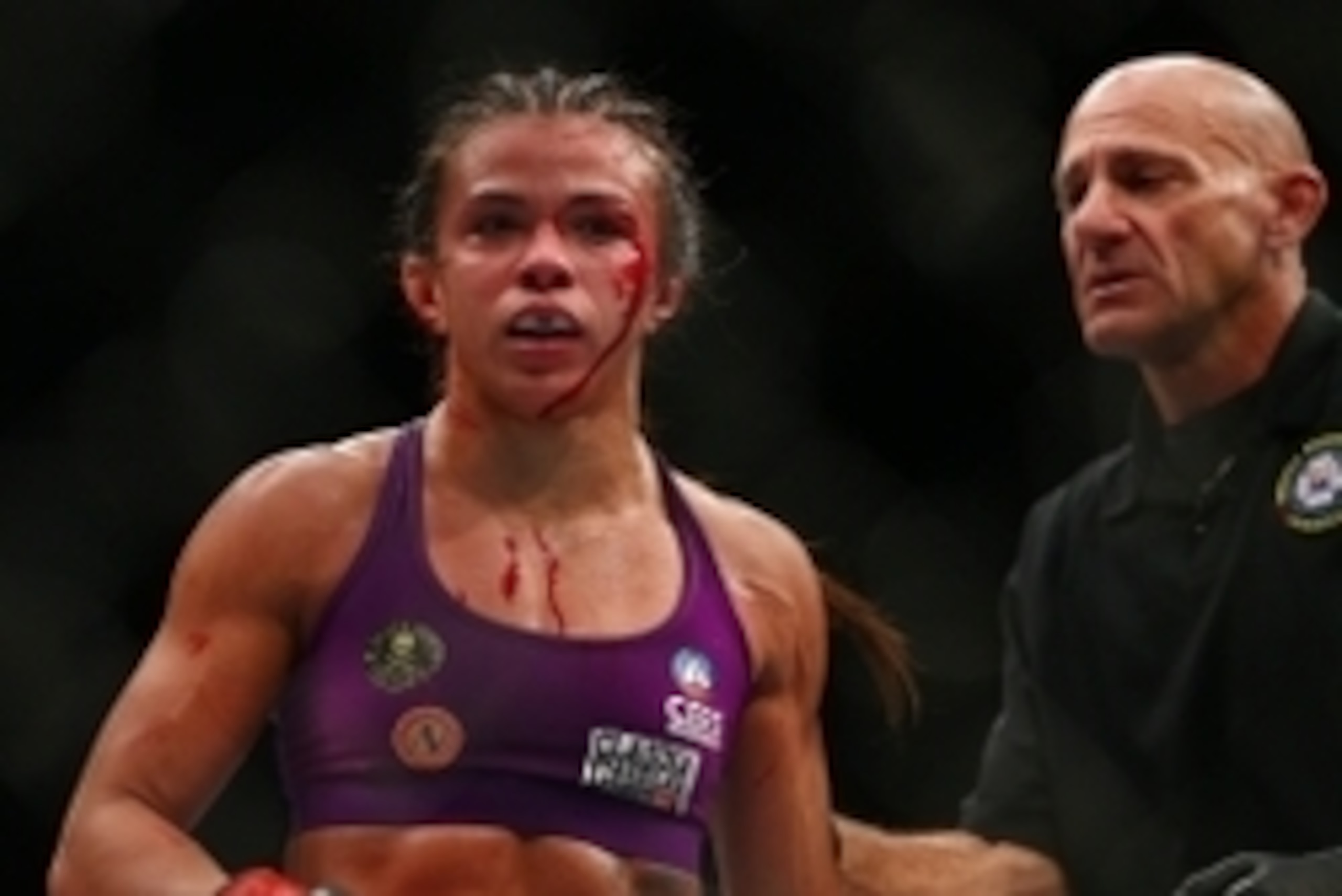 December 13, 2014; Phoenix, AZ, USA; Claudia Gadelha is cut while fighting Joanna Jedrzejczyk during UFC Fight Night at US Airways Center. Mandatory Credit: Mark J. Rebilas-USA TODAY Sports