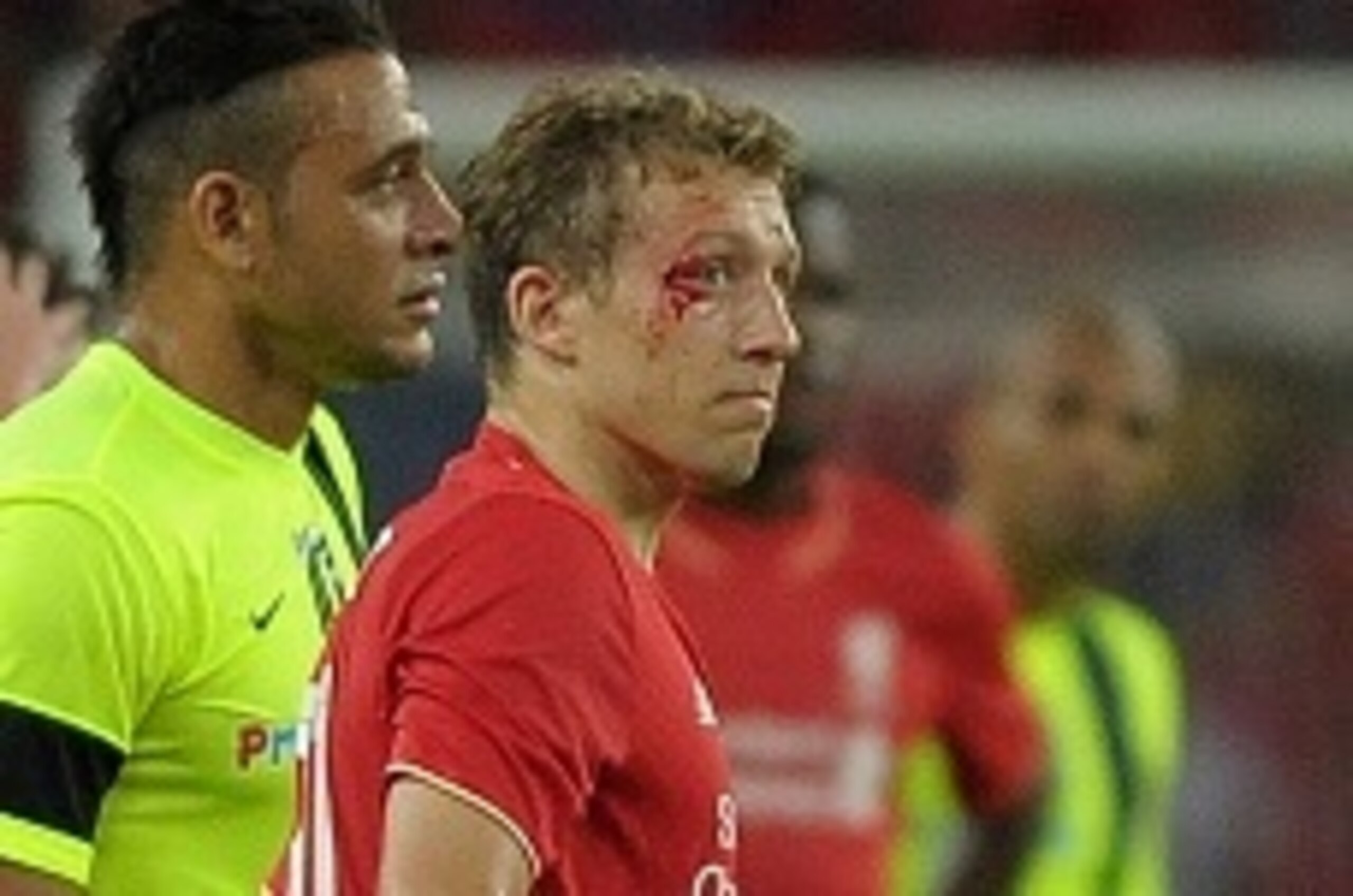 Liverpool's football player Lucas Leiva (R) looks on following an injury on his face during their friendly football match between English Premier League team Liverpool and Malaysia XI in Kuala Lumpur on July 24, 2015. AFP PHOTO / MOHD RASFAN        (Photo