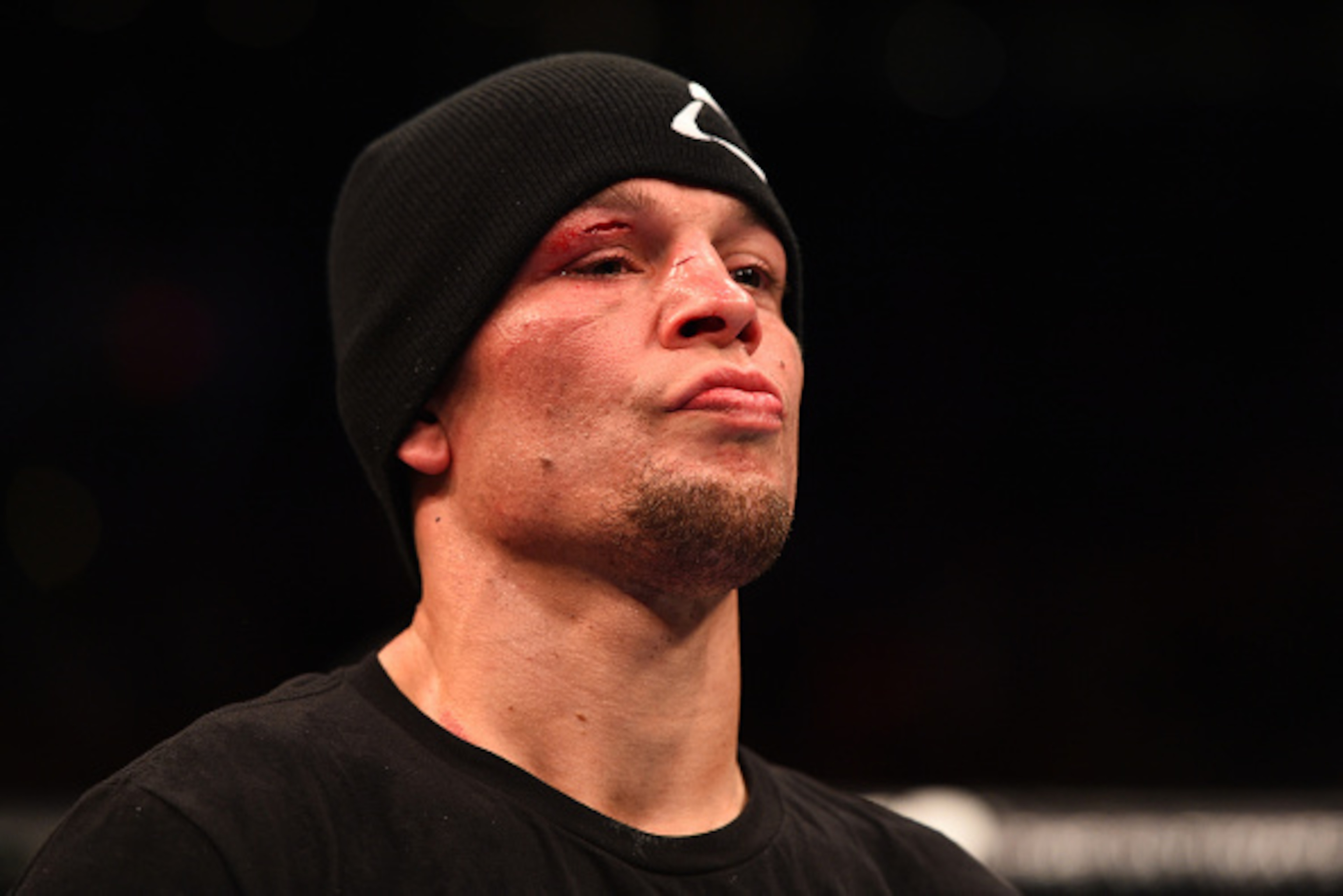 PHOENIX, AZ - DECEMBER 13:  Nate Diaz stands in the Octagon after being defeated by Rafael dos Anjos of Brazil in their lightweight fight during the UFC Fight Night event at the U.S. Airways Center on December 13, 2014 in Phoenix, Arizona.  (Photo by Josh