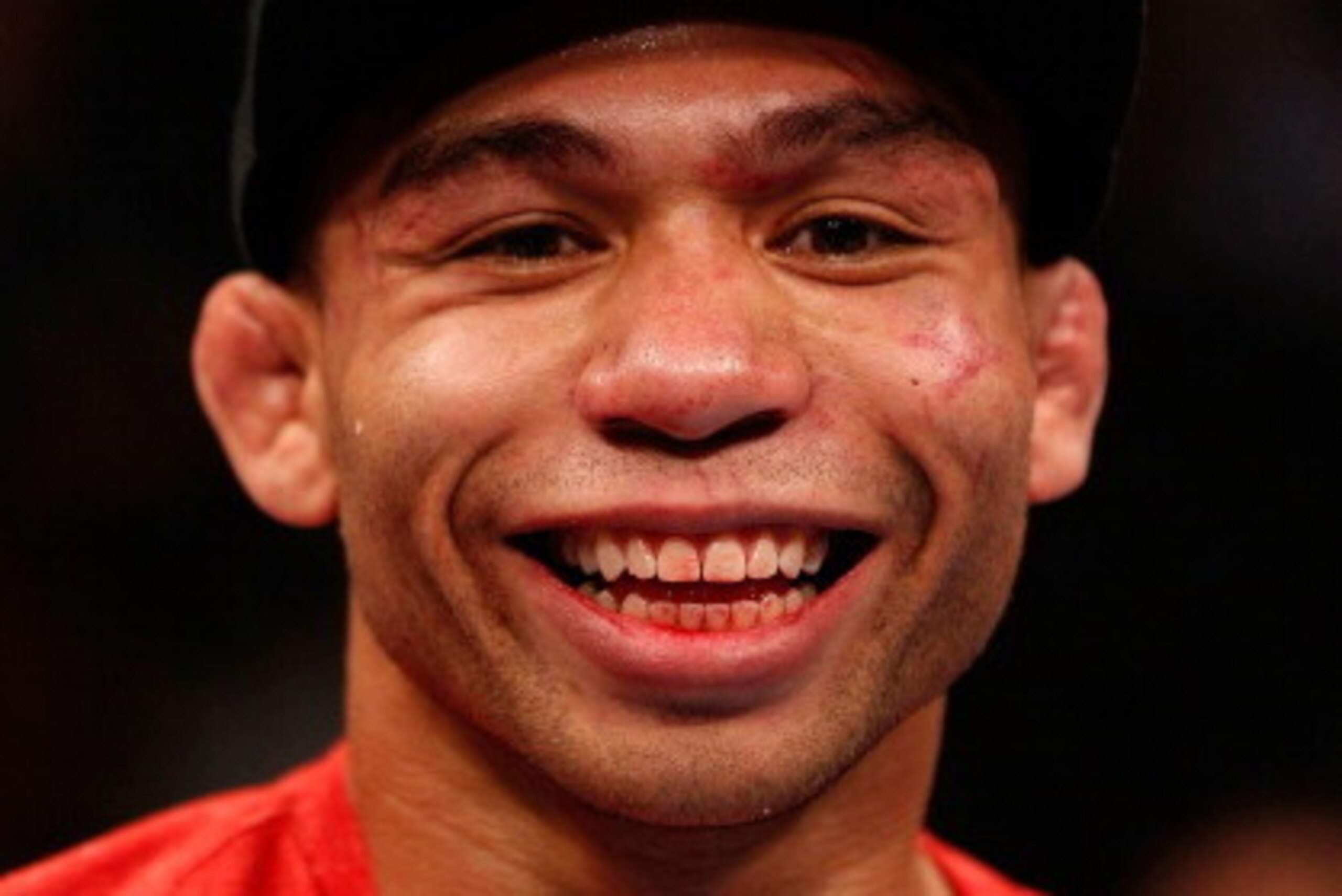 CHICAGO, IL - JANUARY 26:  John Dodson reacts after the conclusion of his five-round flyweight championship fight against Demetrious Johnson during the UFC on FOX event on January 26, 2013 at United Center in Chicago, Illinois. (Photo by Josh Hedges/Zuffa
