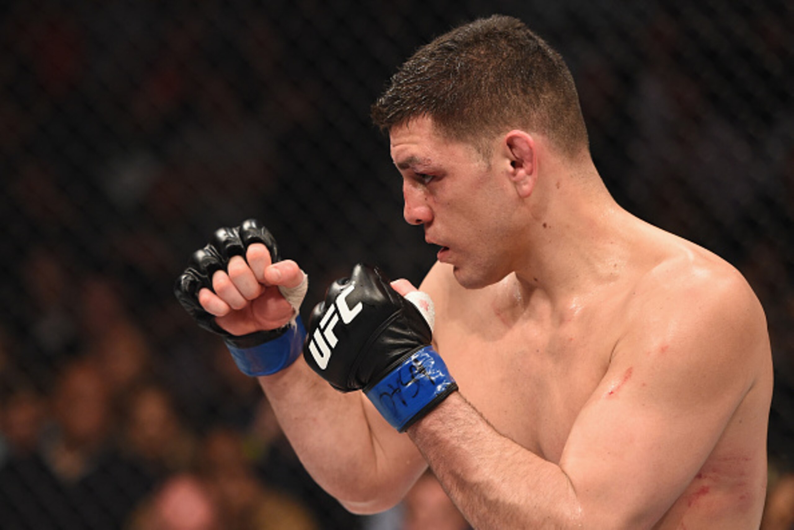 LAS VEGAS, NV - JANUARY 31: Nick Diaz battles Anderson Silva (not pictured) in their middleweight bout during the UFC 183 event at the MGM Grand Garden Arena on January 31, 2015 in Las Vegas, Nevada. (Photo by Josh Hedges/Zuffa LLC/Zuffa LLC via Getty I LAS VEGAS, NV - JANUARY 31: Nick Diaz battles Anderson Silva (not pictured) in their middleweight bout during the UFC 183 event at the MGM Grand Garden Arena on January 31, 2015 in Las Vegas, Nevada. (Photo by Josh Hedges/Zuffa LLC/Zuffa LLC via Getty I