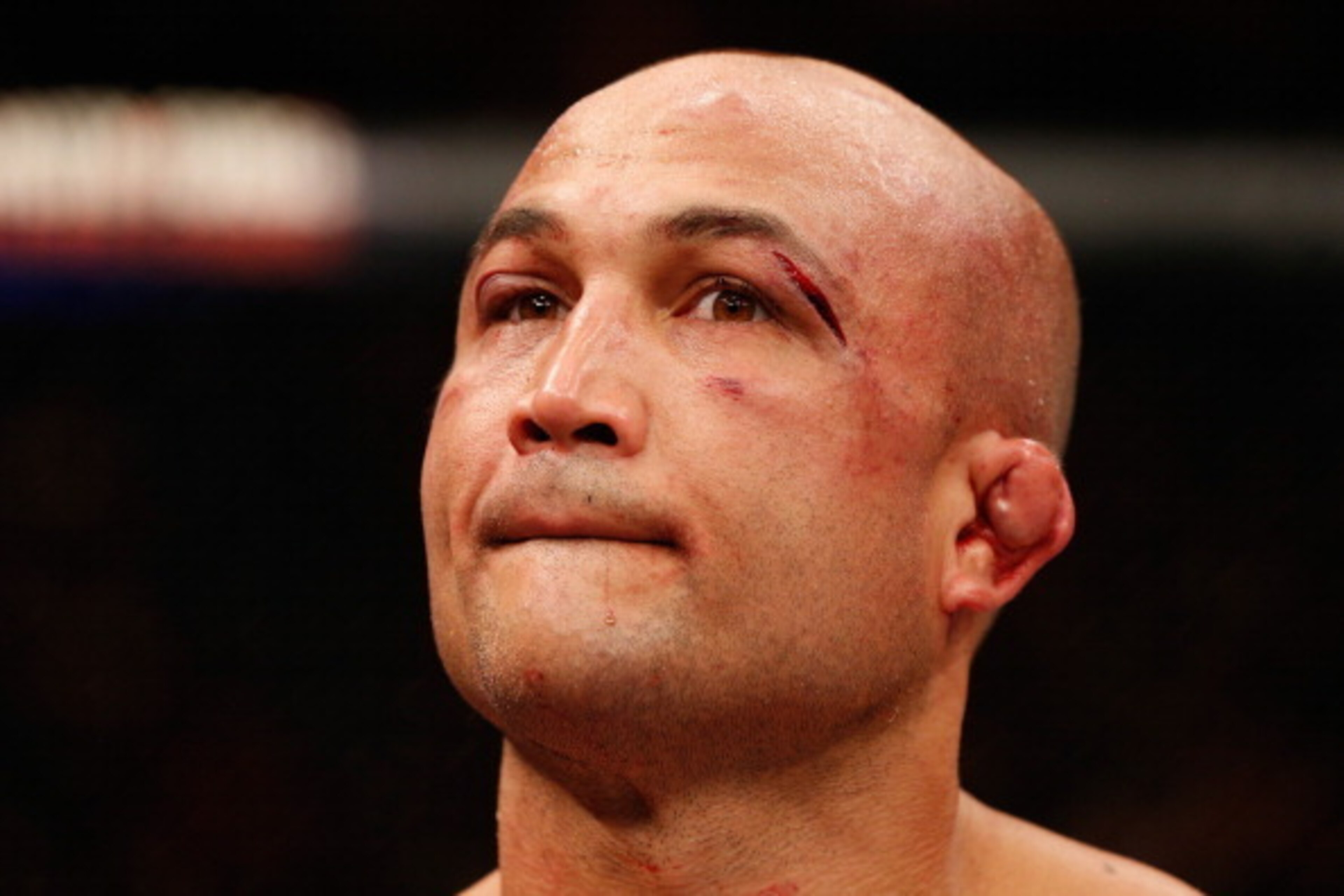 LAS VEGAS, NV - JULY 06: BJ Penn reacts to his loss to Frankie Edgar in their featherweight fight during the Ultimate Fighter Finale inside the Mandalay Bay Events Center on July 6, 2014 in Las Vegas, Nevada. (Photo by Josh Hedges/Zuffa LLC/Zuffa LLC vi LAS VEGAS, NV - JULY 06: BJ Penn reacts to his loss to Frankie Edgar in their featherweight fight during the Ultimate Fighter Finale inside the Mandalay Bay Events Center on July 6, 2014 in Las Vegas, Nevada. (Photo by Josh Hedges/Zuffa LLC/Zuffa LLC vi