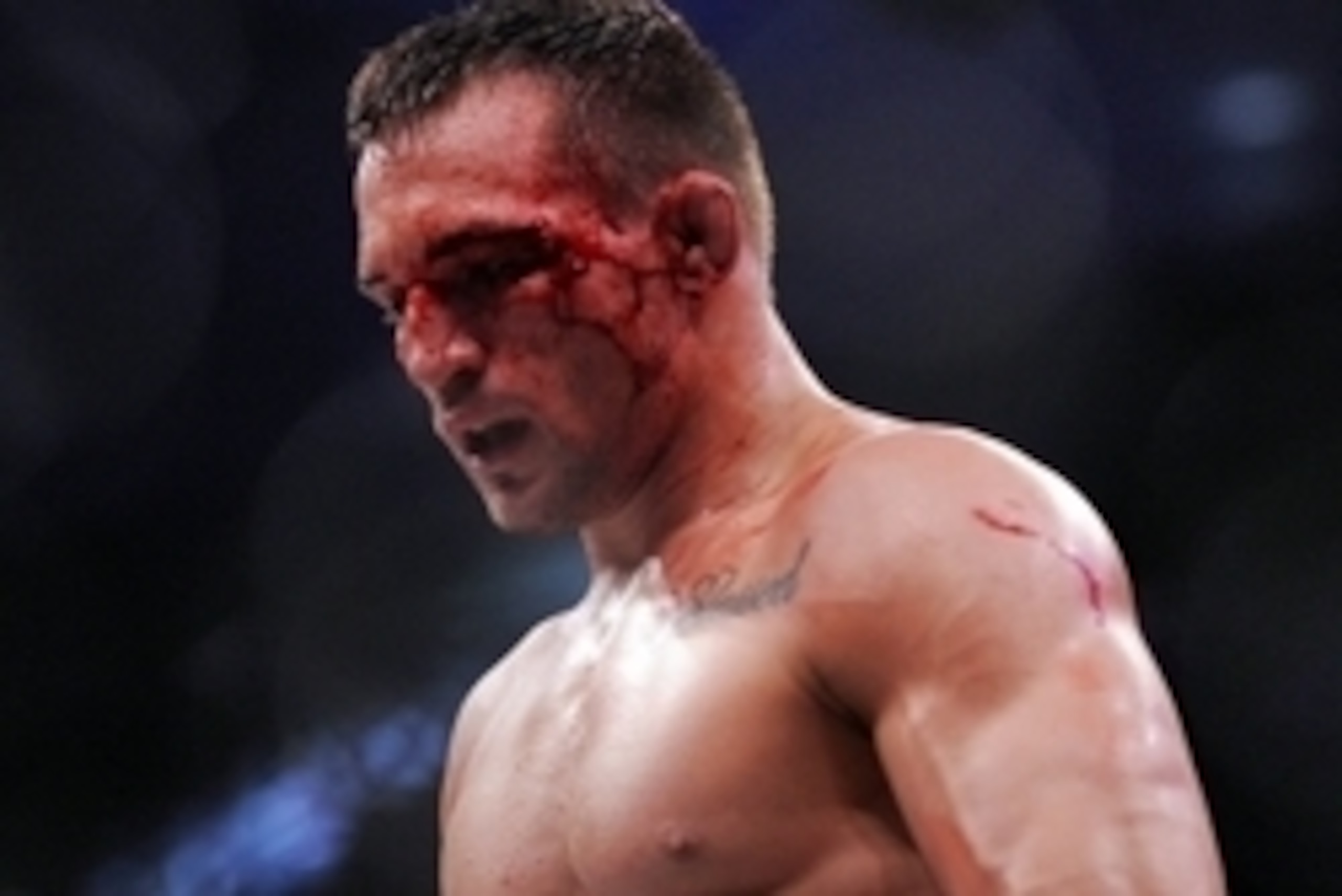 May 17, 2014; Southaven, MS, USA; Michael Chandler between rounds against Will Brooks during a Bellator interim lightweight world championship bout during BFC 120 at Landers Center. Will Brooks defeats Michael Chandler by submission. Mandatory Credit: Jus