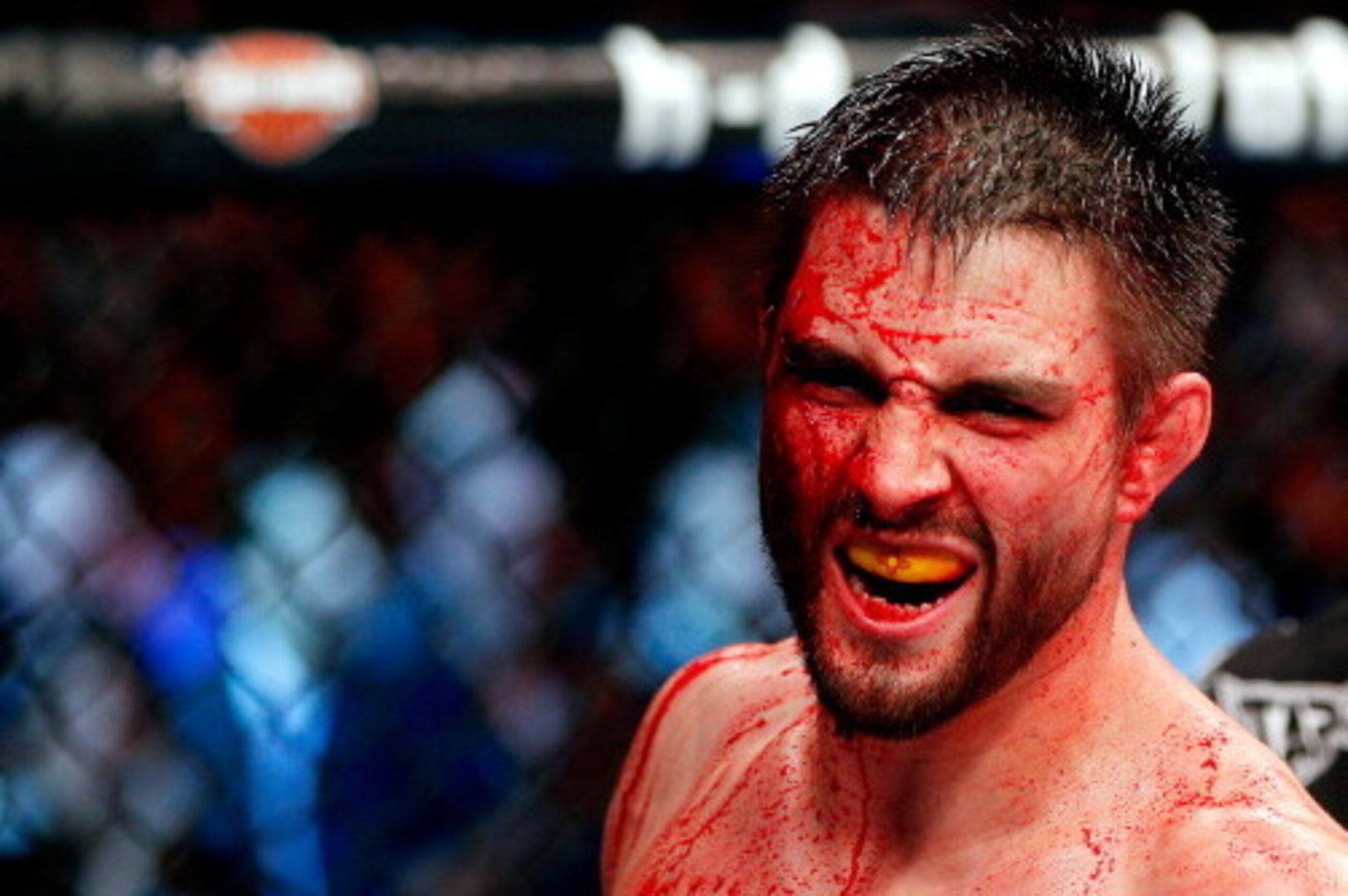 MONTREAL, QC - NOVEMBER 17:  A cut and bloodied Carlos Condit reacts after a round against Georges St-Pierre in their welterweight title bout during UFC 154 on November 17, 2012  at the Bell Centre in Montreal, Canada.  (Photo by Josh Hedges/Zuffa LLC/Zuf