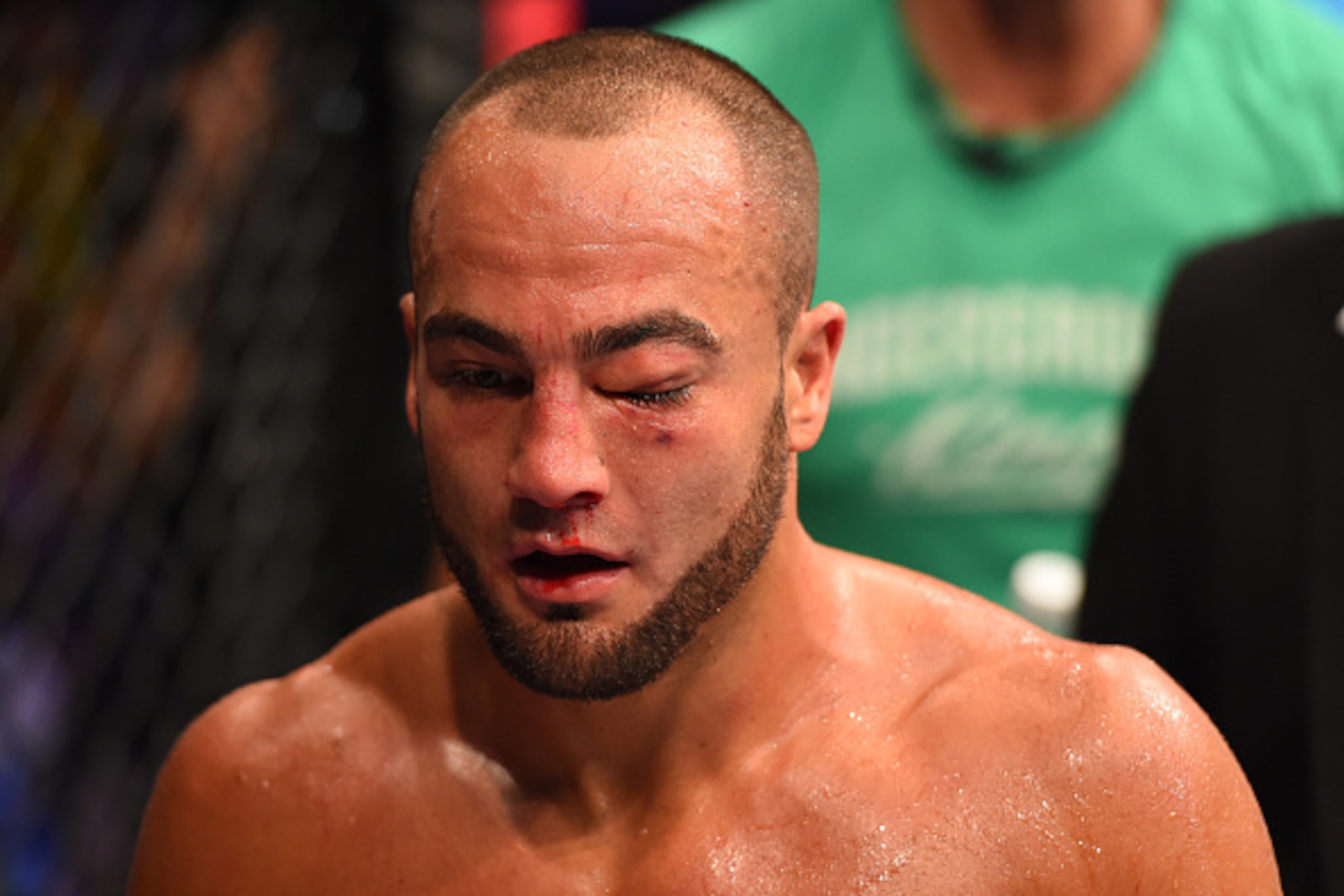 MEXICO CITY, MEXICO - JUNE 13:  (L-R) Eddie Alvarez of the United States has his eye swell up in between rounds while facing Gilbert Melendez of the United States in their lightweight bout during the UFC 188 event at the Arena Ciudad de Mexico on June 13,