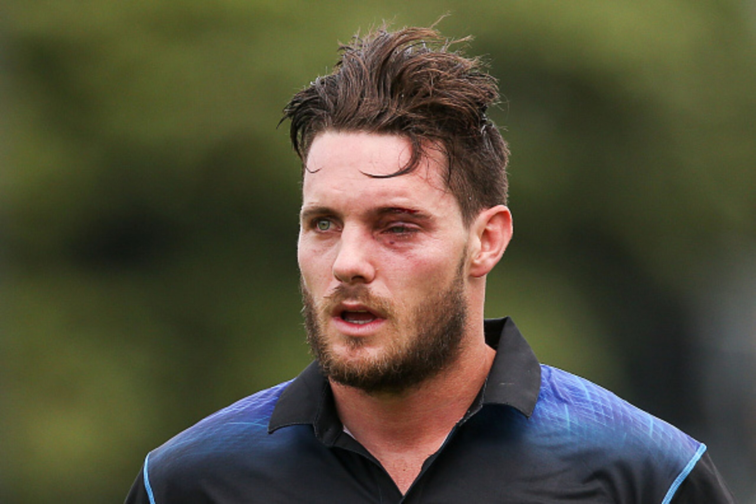 WELLINGTON, NEW ZEALAND - JANUARY 25:  Mitchell McClenaghan of New Zealand leaves the field with an injured eye after being struck by a bouncer while batting during the One Day International match between New Zealand and Pakistan at Basin Reserve on Janua