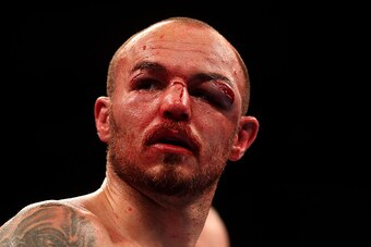 LONDON, ENGLAND - MAY 30:  Kevin Mitchell of England looks on following his WBC World Lightweight Championship bout against Jorge Linares of Venezuela at The O2 Arena on May 30, 2015 in London, England.  (Photo by Ben Hoskins/Getty Images)