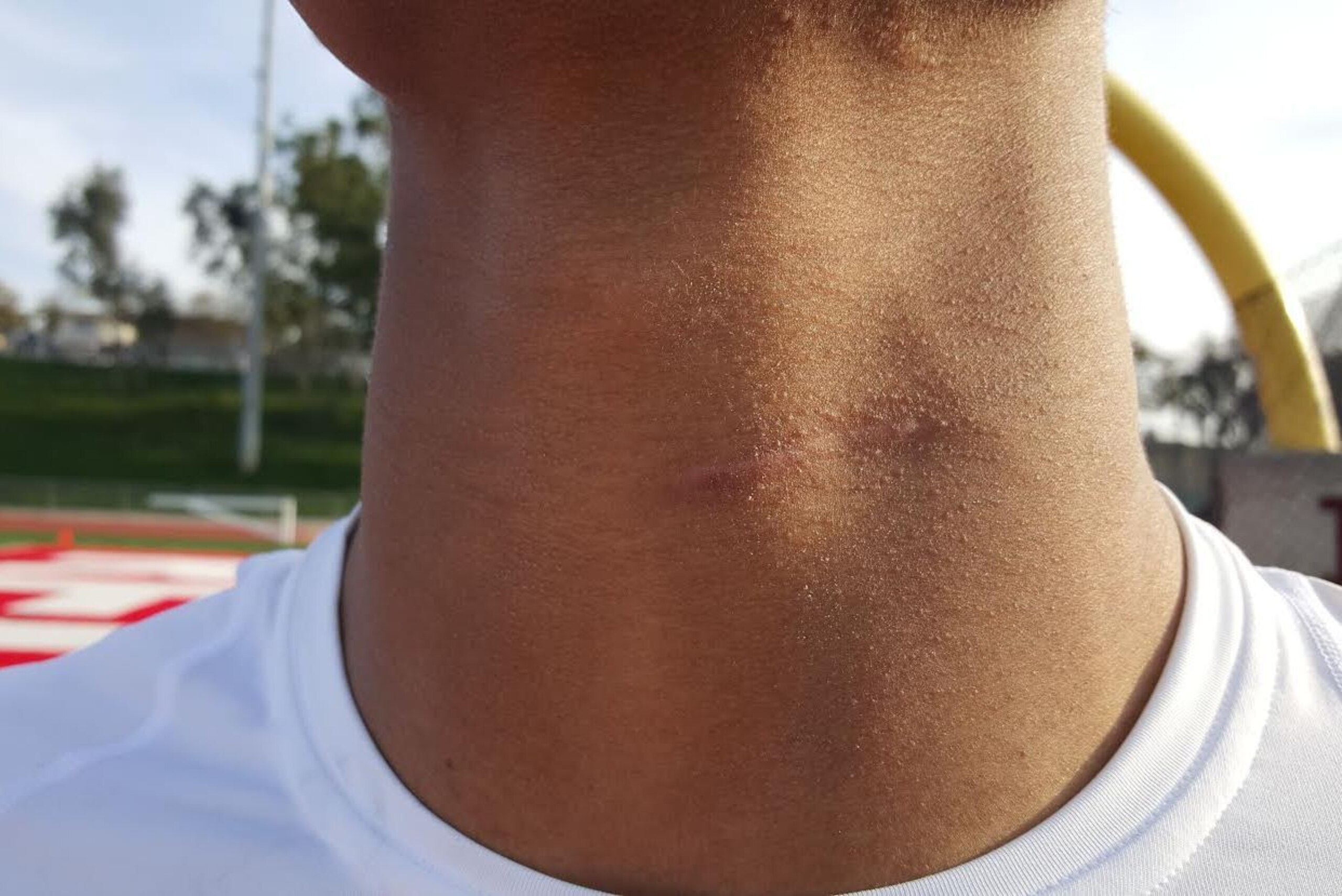 The scar on Nephi Sewell's neck will serve as a constant reminder of what happened in August of last year. It also will show how mentally and physically strong he is after returning to the field in a non-contact role last Sunday.