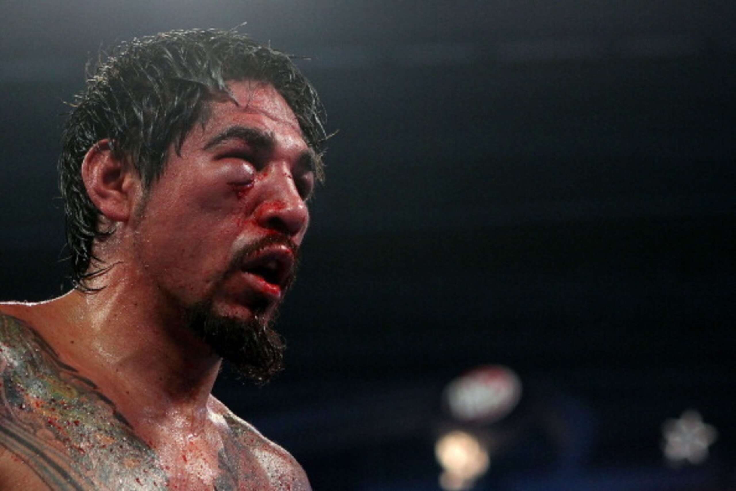 ARLINGTON, TX - NOVEMBER 13:  A detail of the cut on the right eye of Antonio Margarito (black trunks) of Mexico is seen as he fights against Manny Pacquiao (white trunks) of the Philippines during their WBC World Super Welterweight Title bout at Cowboys 