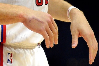 LOS ANGELES, CA - APRIL 3: A scar is seen on the right hand of Blake Griffin #32 of the Los Angeles Clippers during the basketball game against Washington Wizards at Staples Center April 3, 2016, in Los Angeles, California. Griffin rejoined the Clippers a