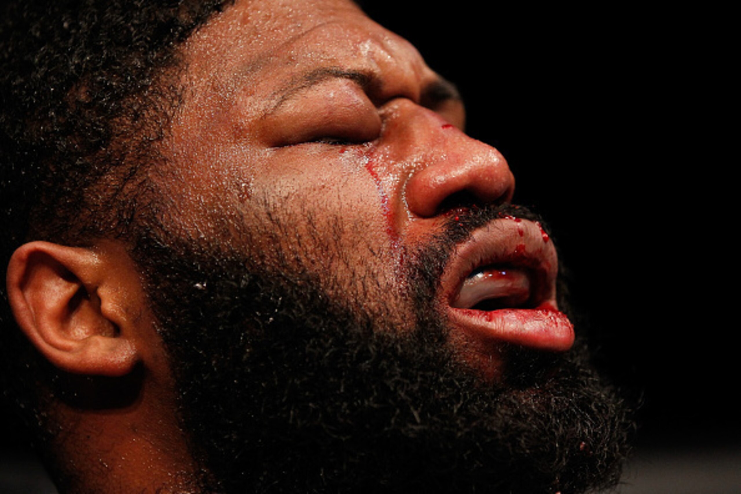 ZAGREB, CROATIA - APRIL 10:   Curtis Blaydes reacts to his doctor stoppage loss to Francis Ngannou in their heavyweight bout during the UFC Fight Night event at the Arena Zagreb on April 10, 2016 in Zagreb, Croatia. (Photo by Srdjan Stevanovic/Zuffa LLC/Z