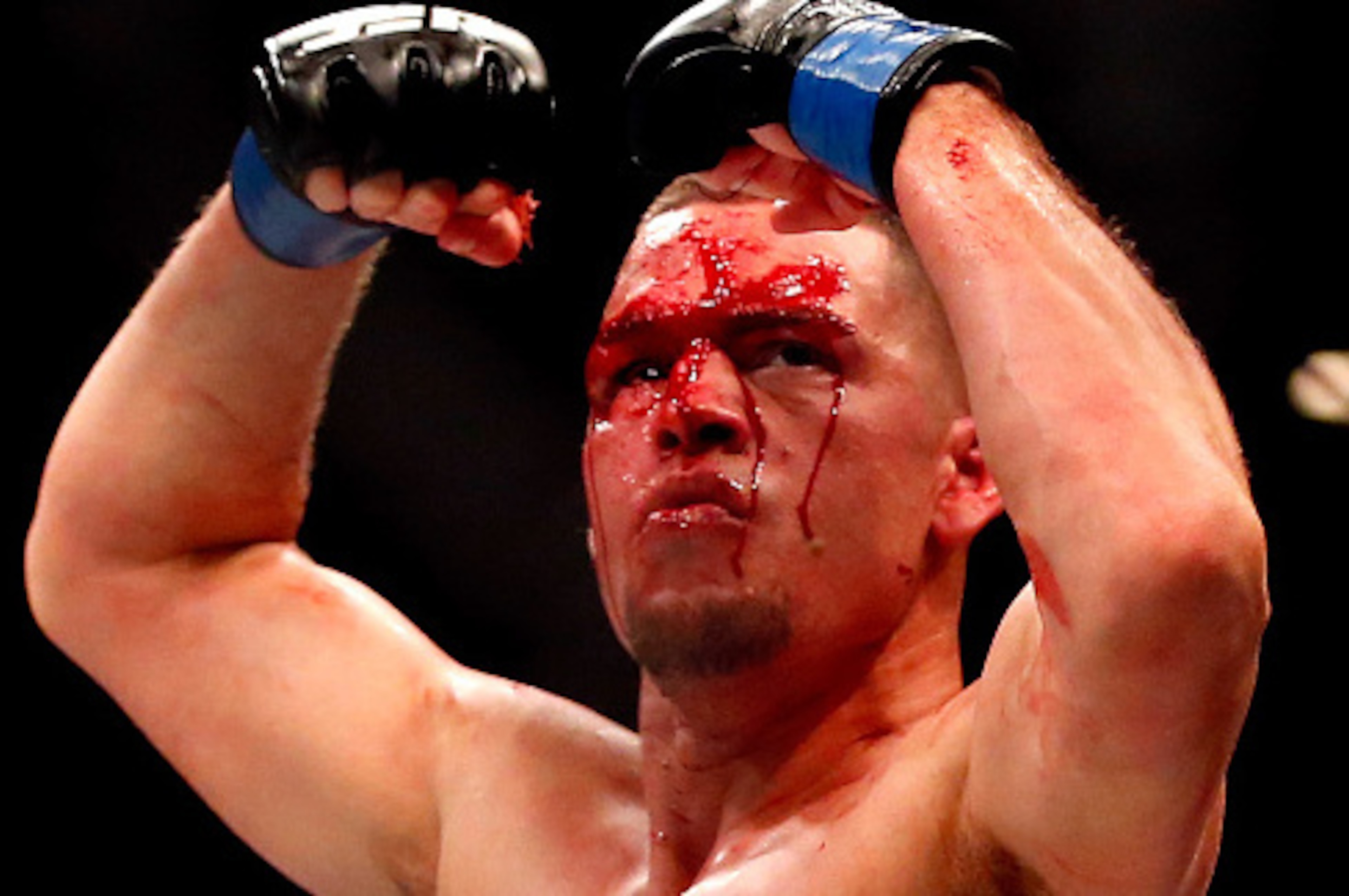 LAS VEGAS, NV - MARCH 05: Nate Diaz reacts to his victory over Conor McGregor of Ireland in their welterweight bout during the UFC 196 event inside MGM Grand Garden Arena on March 5, 2016 in Las Vegas, Nevada.  (Photo by Christian Petersen/Zuffa LLC/Zuffa
