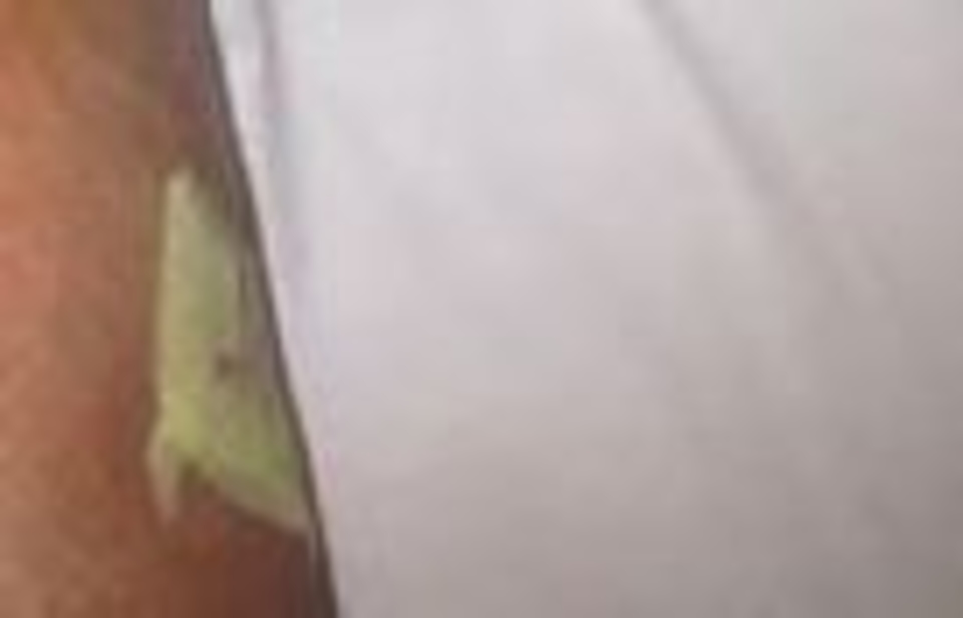 Zingano's knee post-surgery.