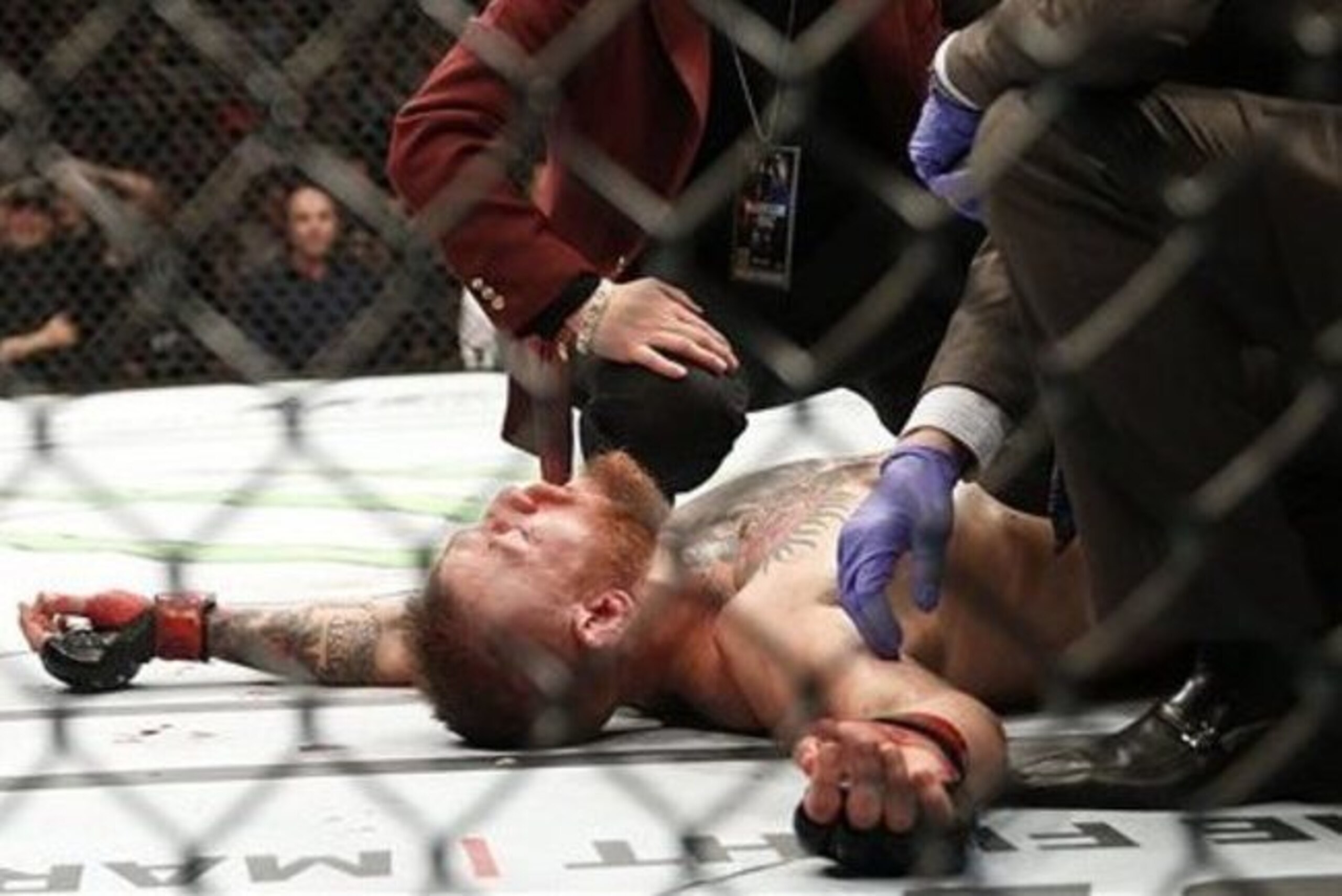McGregor suffered a tough loss at UFC 196. McGregor suffered a tough loss at UFC 196.