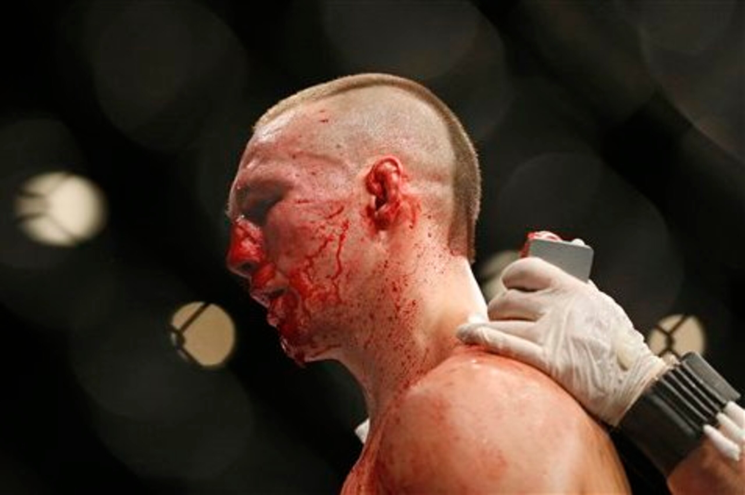 MacDonald bloodied during his fight with Robbie Lawler.