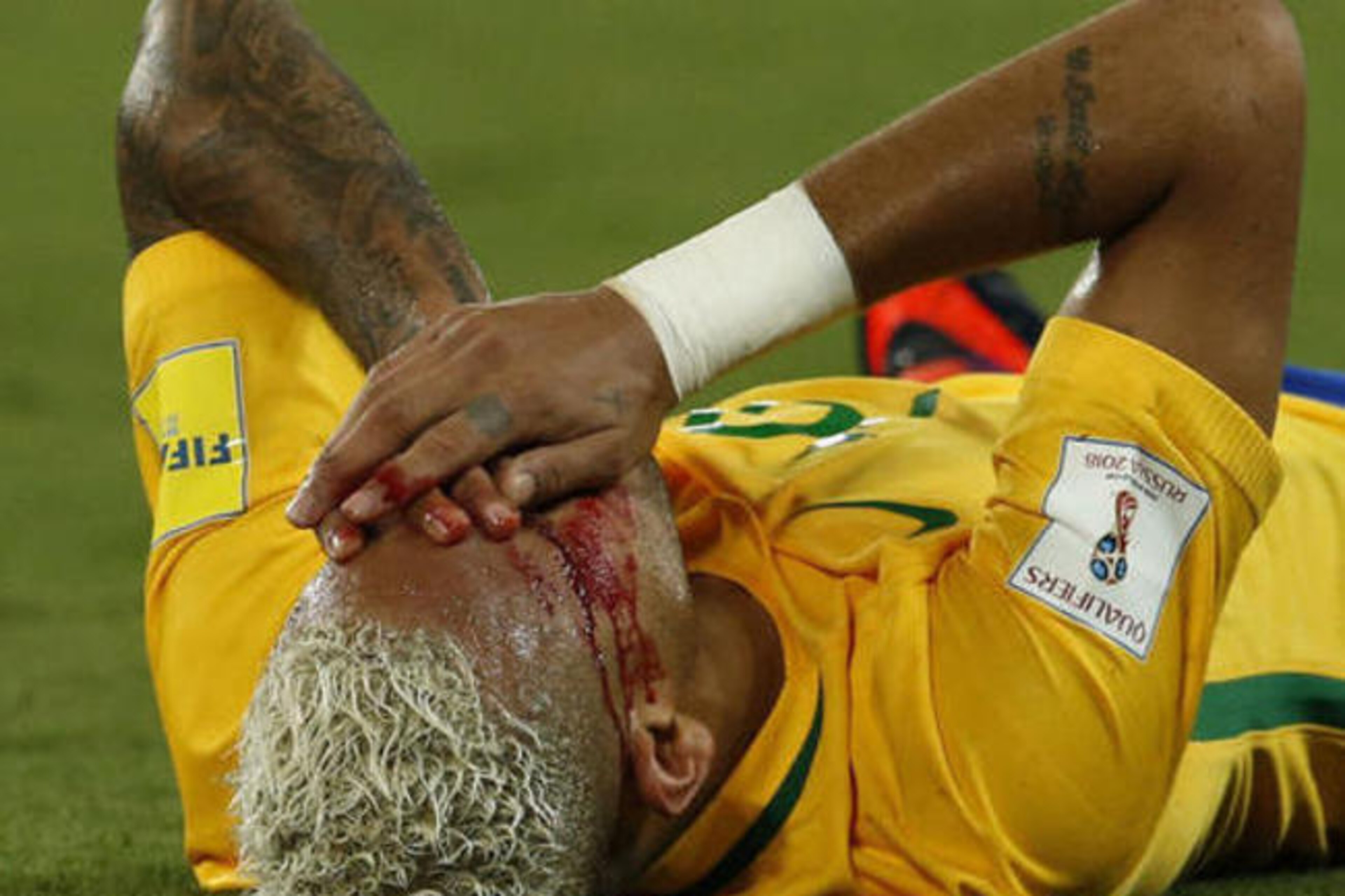 Yasmani Duk's elbow on Neymar led to bloody scenes.