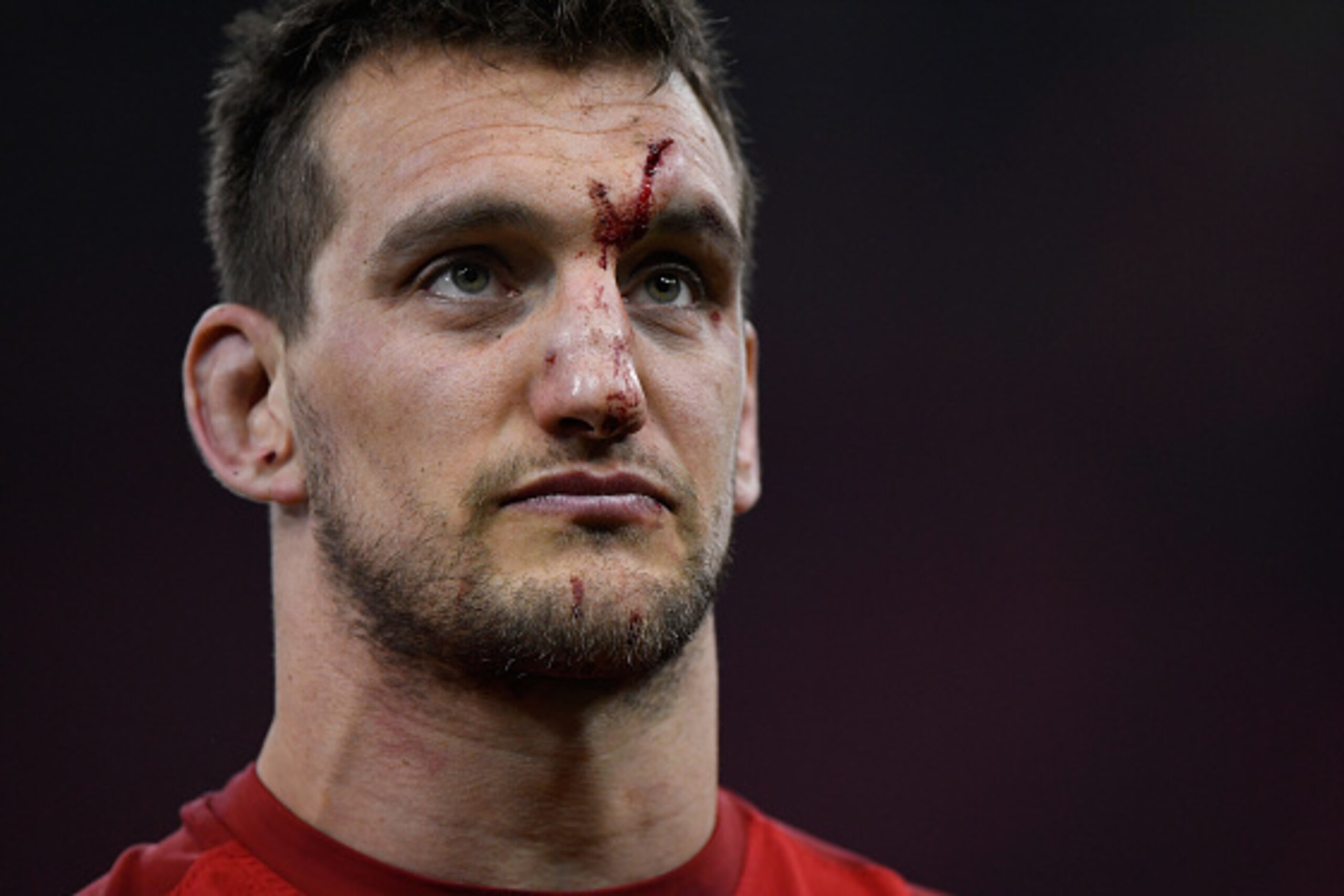 CARDIFF, WALES - FEBRUARY 11:  A bloodied Sam Warburton of Wales reacts after the RBS Six Nations match between Wales and England at Principality Stadium on February 11, 2017 in Cardiff, Wales.  (Photo by Stu Forster/Getty Images)