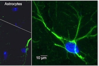 Astrocyte cells, depicted here, are the focus of Dr. William Korinek's research into combatting the effects of brain trauma.