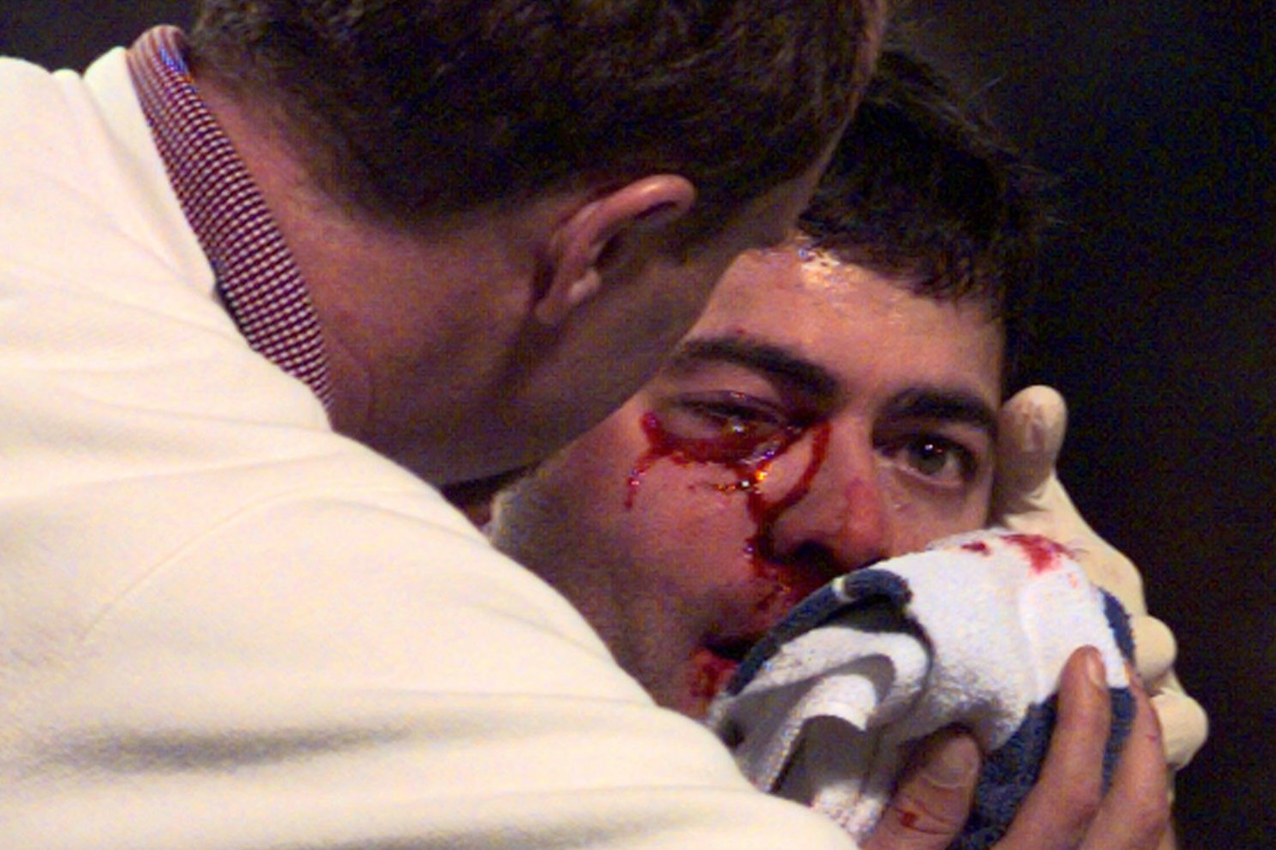 Bryce Florie's bloody eye after a horrifying comebacker.