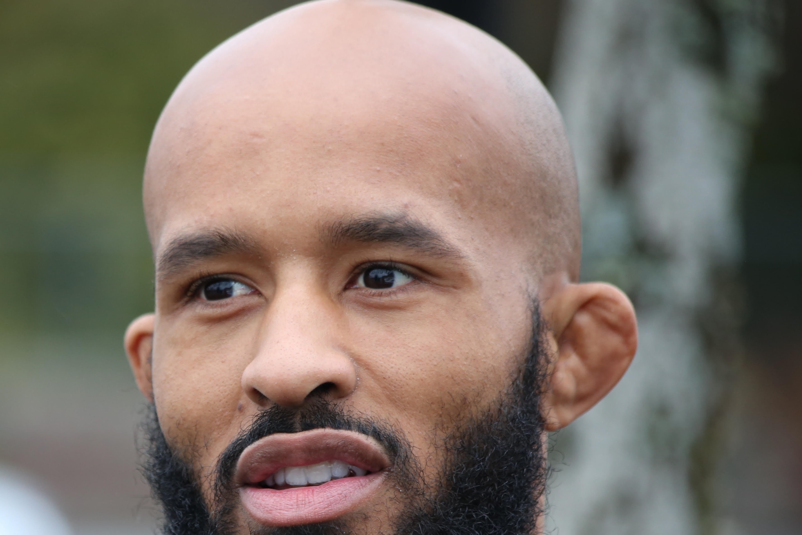Demetrious Johnson's cauliflower ear