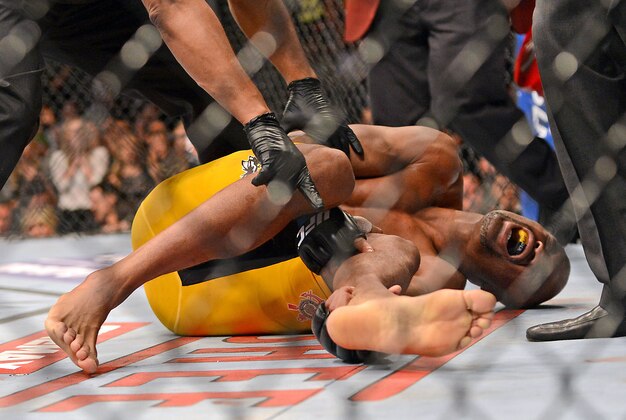 Dec 28, 2013; Las Vegas, NV, USA;    Anderson Silva reacts after breaking his leg on a kick to Chris Weidman (not pictured) during their UFC middleweight championship bout at the MGM Grand Garden Arena. Mandatory Credit: Jayne Kamin-Oncea-USA TODAY Sports