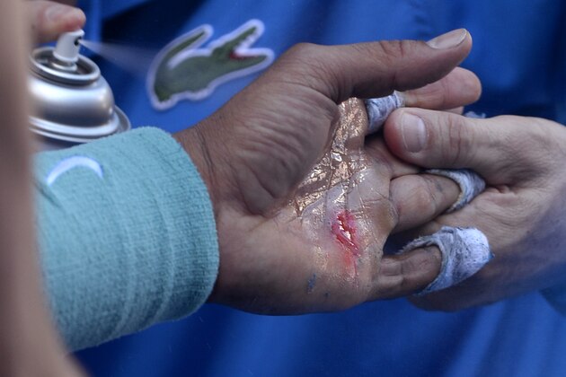 Rafael Nadal of Spain receives medical treatment to a blister on his hand during his quarterfinal against Grigor Dimitrov of Bulgaria at the Australian Open tennis championship in Melbourne, Australia, Wednesday, Jan. 22, 2014.(AP Photo/Andrew Brownbill)