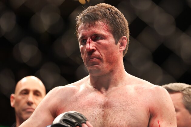 A defeated Chael Sonnen is seen after losing to Champion Jon Jones in their UFC 159 Mixed Martial Arts light heavyweight title bout in Newark, N.J., Saturday, April 27,2013.  Jones retained his title via  first round TKO. (AP Photo/Gregory Payan)