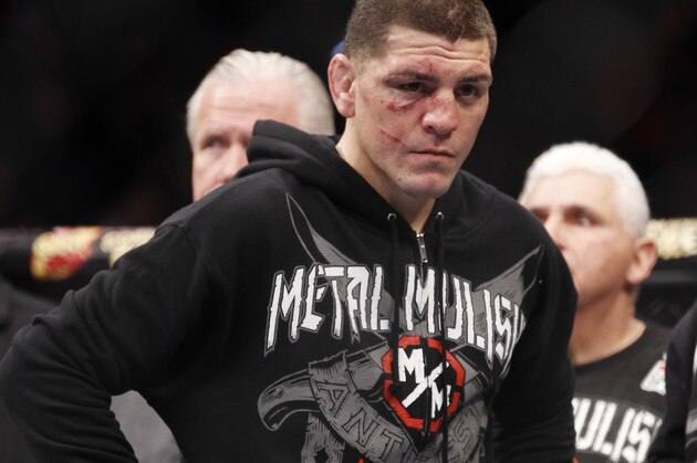 Nick Diaz reacts after Carlos Condit wins a unanimous decision just after their UFC interim welterweight mixed martial arts title match, Saturday, Feb. 4, 2012 at The Mandalay Bay Resort & Casino in Las Vegas. (AP Photo/Eric Jamison)