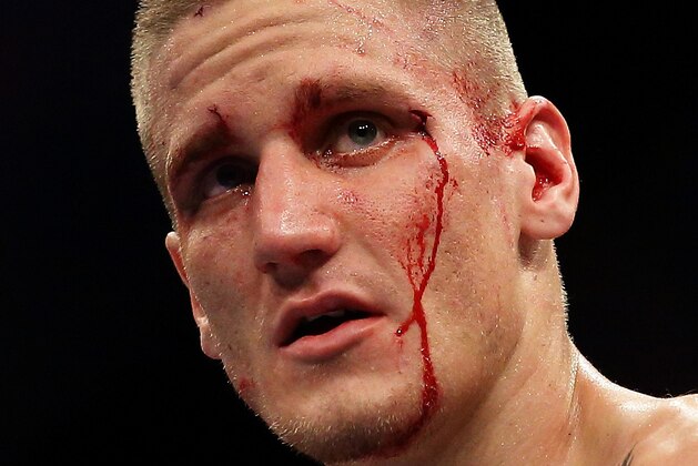 SINGAPORE - JANUARY 04: Will Chope reacts after losing to Max Holloway  during their UFC Fight Night Singapore featherweight bout at Marina Bay Sands on January 4, 2014 in Singapore.  (Photo by Suhaimi Abdullah/Getty Images)