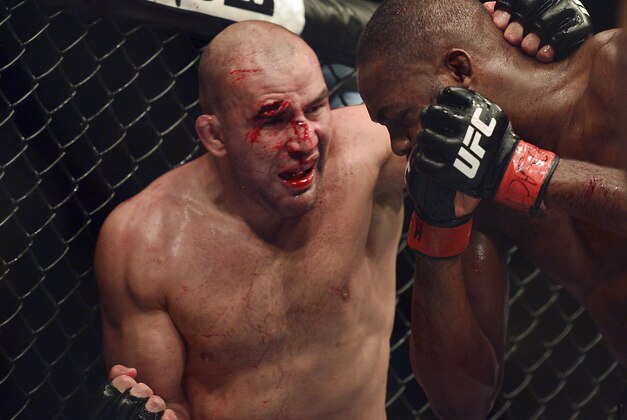 Apr 26, 2014; Baltimore, MD, USA;  A cut opens up over the eye of Glover  Teixeira during the UFC light heavy weight championship fight against Jon Jones at  Baltimore Arena. Jones retained the light heavy height championship by defeating  Teixeria.  Mandatory Credit: Tommy Gilligan-USA TODAY Sports