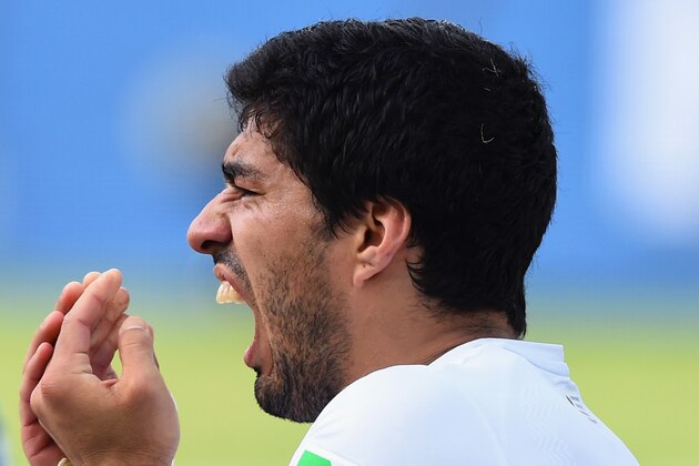 NATAL, BRAZIL - JUNE 24:  Luis Suarez of Uruguay reacts after a clash during the 2014 FIFA World Cup Brazil Group D match between Italy and Uruguay at Estadio das Dunas on June 24, 2014 in Natal, Brazil.  (Photo by Matthias Hangst/Getty Images)