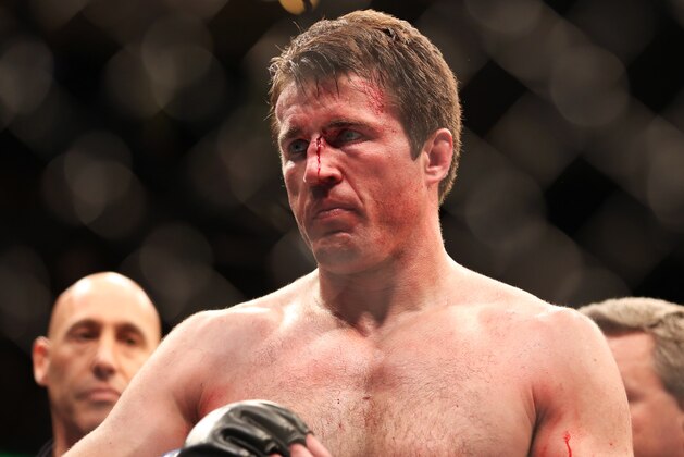 A defeated Chael Sonnen is seen after losing to Champion Jon Jones in their UFC 159 Mixed Martial Arts light heavyweight title bout in Newark, N.J., Saturday, April 27,2013.  Jones retained his title via  first round TKO. (AP Photo/Gregory Payan)