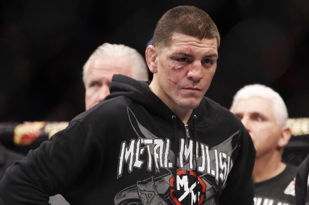 Nick Diaz reacts after Carlos Condit wins a unanimous decision just after their UFC interim welterweight mixed martial arts title match, Saturday, Feb. 4, 2012 at The Mandalay Bay Resort & Casino in Las Vegas. (AP Photo/Eric Jamison)