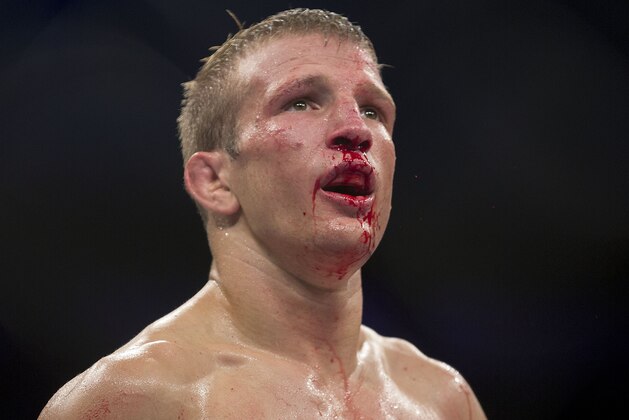 TJ Dillashaw, from the U.S., bleeds during his Bantamweight mixed martial arts bout against Raphael Assuncao, from Brazil, at the Ultimate Fighting Championship in Barueri, on the outskirt of Sao Paulo, Brazil, Wednesday, Oct. 9, 2013. (AP Photo/Andre Penner)