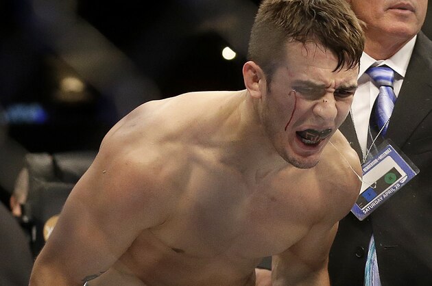 Myles Jury celebrates after beating Ramsey Nijem during the second round of a UFC lightweight mixed martial arts fight in San Jose, Saturday, April 20, 2013. Jury won by knock out in the second round. (AP Photo/Jeff Chiu)