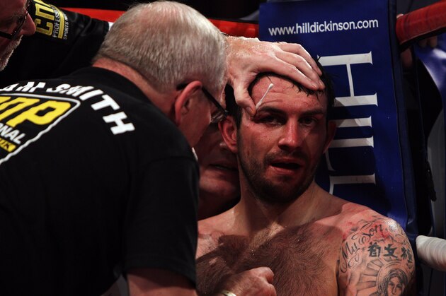 LIVERPOOL, ENGLAND - DECEMBER 11:  Paul Smith of Liverpool is attended to by his corner between rounds in his fight with James DeGale of Harlsden in their Super-Middleweight Championship of the World fight during the Frank Warren 30 Years anniversary show at Echo Arena on December 11, 2010 in Liverpool, England.  (Photo by Dean Mouhtaropoulos/Getty Images)