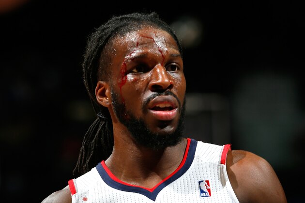 ATLANTA, GA - MARCH 18:  DeMarre Carroll #5 of the Atlanta Hawks reacts to a call as blood drips down his face against the Toronto Raptors at Philips Arena on March 18, 2014 in Atlanta, Georgia.  NOTE TO USER: User expressly acknowledges and agrees that, by downloading and or using this photograph, User is consenting to the terms and conditions of the Getty Images License Agreement.  (Photo by Kevin C. Cox/Getty Images)
