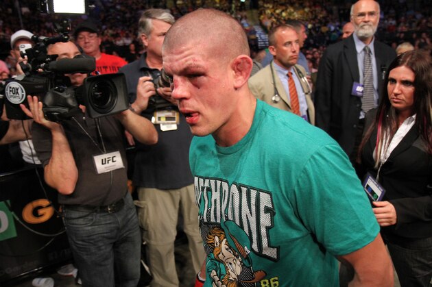 Joe Lauzon leaves the ring after his loss against Michael Johnson in their UFC on Fox Sports 1 mixed martial arts bout in Boston, Saturday, August 17,2013. Johnson won via unanimous decison. (AP Photo/Gregory Payan)