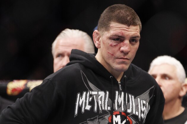 FILE - In this Feb. 4, 2012, file photo, Nick Diaz stands after Carlos Condit won a unanimous decision in their UFC welterweight mixed martial arts bout in Las Vegas. The head of the Nevada Athletic Commission says Diaz tested positive for marijuana after his recent loss to Condit and faces disciplinary action, including a possible suspension and fine. Executive director Keith Kizer said Thursday, Feb. 9, 2012. that Diaz's license has been temporarily suspended and he will have 20 days to respond to the allegations. (AP Photo/Eric Jamison, File)