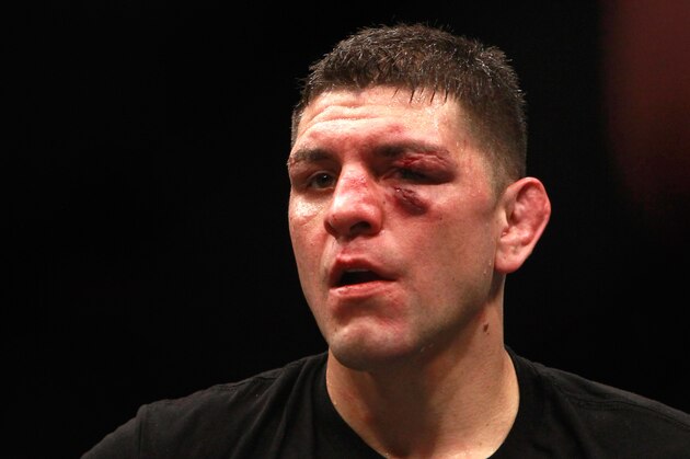 LAS VEGAS, NV - JANUARY 31:  Nick Diaz  stands in the Octagon after five rounds against Anderson Silva in a middleweight bout during UFC 183 at the MGM Grand Garden Arena on January 31, 2015 in Las Vegas, Nevada. Silva won by unanimous decision.  (Photo by Steve Marcus/Getty Images)