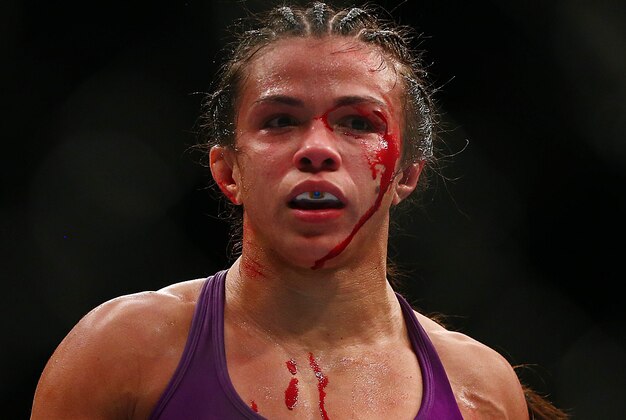 December 13, 2014; Phoenix, AZ, USA; Claudia Gadelha is cut while fighting Joanna Jedrzejczyk during UFC Fight Night at US Airways Center. Mandatory Credit: Mark J. Rebilas-USA TODAY Sports