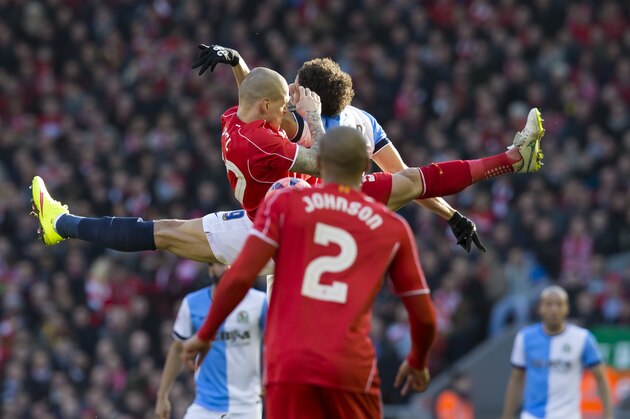 Liverpool's Martin Skrtel, upper left, is injured as he jumps for the ball against Blackburn's Rudy Gestede during the English FA Cup quarter final soccer match between Liverpool and Blackburn at Anfield Stadium, Liverpool, England, Sunday March 8, 2015. (AP Photo/Jon Super)