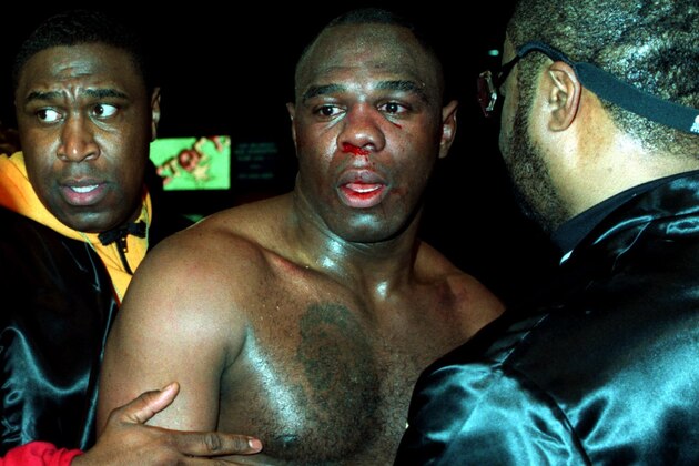 19 MAR 1994:  MICHAEL BENTT OF THE USA IS LED AWAY BY HIS CORNERMEN, BADLY SHAKEN AND WITH HIS FACE BLOODIED, AFTER LOSING HIS  WBO HEAVYWEIGHT TITLE FIGHT TO HERBIE HIDE OF GREAT BRITAIN AT THE NEW DEN AT MILLWALL, LONDON. HIDE WON THE FIGHT WITH A KNOCKOUT IN THE 7TH ROUND, HAVING ALREADY KNOCKED BENTT DOWN ONCE IN THE THIRD ROUND.  Mandatory Credit: John Gichigi/ALLSPORT