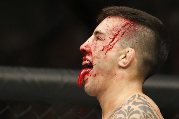 Thomas Almeida reacts between rounds in a bantamweight mixed martial arts bout against Brad Pickett at UFC 189 on Saturday, July 11, 2015, in Las Vegas. (AP Photo/John Locher)