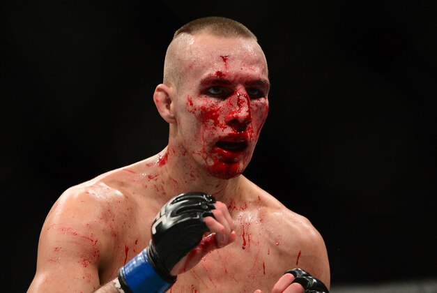 Jul 11, 2015; Las Vegas, NV, USA; Robbie Lawler (not pictured) and Rory MacDonald (blue gloves) fight during their welterweight title bout during UFC 189 at MGM Grand Garden Arena. Lawler won via fifth round TKO. Mandatory Credit: Joe Camporeale-USA TODAY Sports