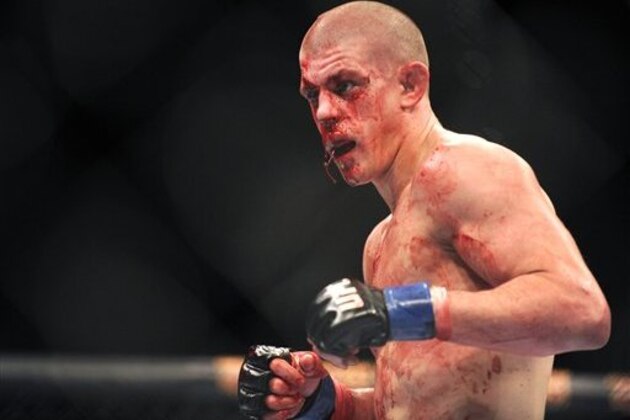EDS NOTE: GRAPHIC CONTENT-Joe Lauzon of Bridgewter, Mass. with a bloody face puts up his fists during his UFC 155 lightweight mixed martial arts match against Jim Miller of Whippany, N.J.   at the MGM Grand Garden Arena Saturday, Dec, 29, 2012 in Las  Vegas. Miller won the bout with an unanimous decision. (AP Photo/David Becker)