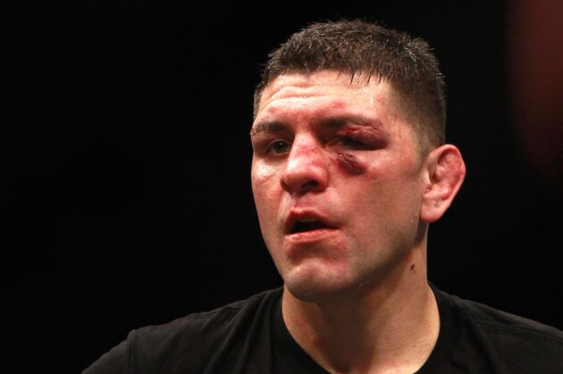 LAS VEGAS, NV - JANUARY 31:  Nick Diaz  stands in the Octagon after five rounds against Anderson Silva in a middleweight bout during UFC 183 at the MGM Grand Garden Arena on January 31, 2015 in Las Vegas, Nevada. Silva won by unanimous decision.  (Photo by Steve Marcus/Getty Images)