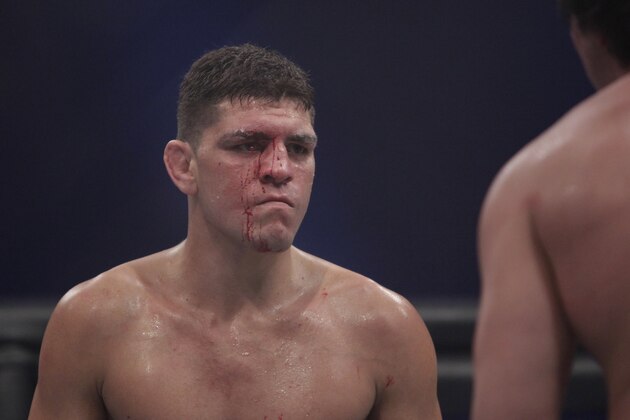 Nick Diaz, faces off with K.J. Noons in the second round of their Strikeforce welterweight championship match in San Jose, Calif., Saturday, Oct. 9, 2010. Diaz won by unanimous decision to retain his championship. (AP Photo/Jeff Chiu)